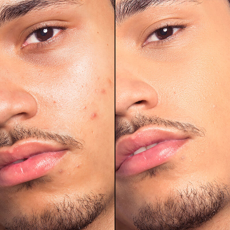 HD SKIN HD SKIN