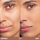 HD SKIN