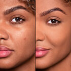 HD SKIN