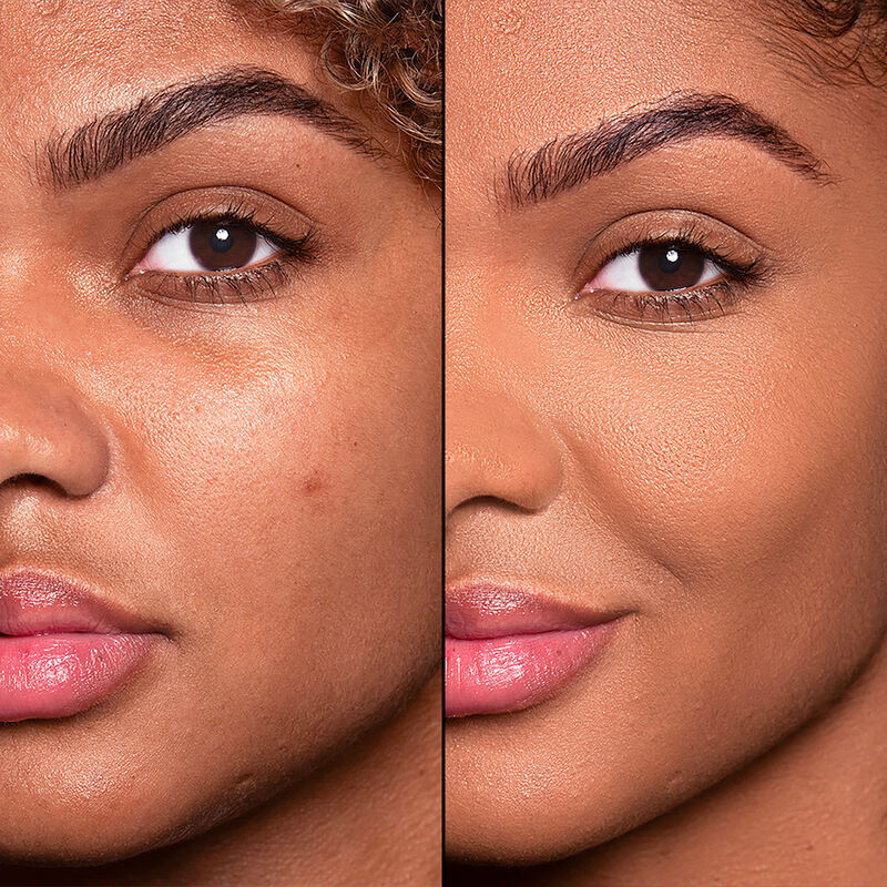 HD SKIN HD SKIN