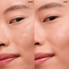 INFINITY COMPLEXION SET