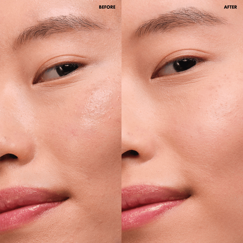 INFINITY COMPLEXION SET INFINITY COMPLEXION SET