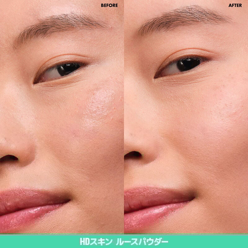 インフィニティ コンプレクション セット