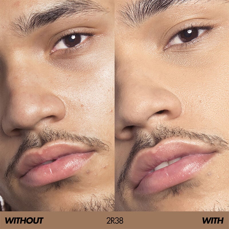 HD SKIN HD SKIN