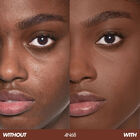 HD SKIN