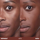 HD SKIN