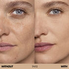 HD SKIN