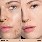 HD SKIN