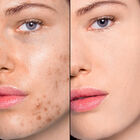 HD SKIN