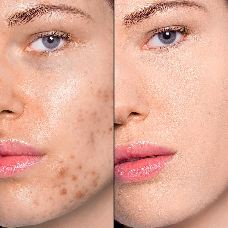 HD SKIN HD SKIN