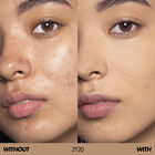 HD SKIN