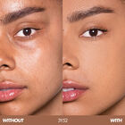 HD SKIN