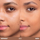 HD SKIN