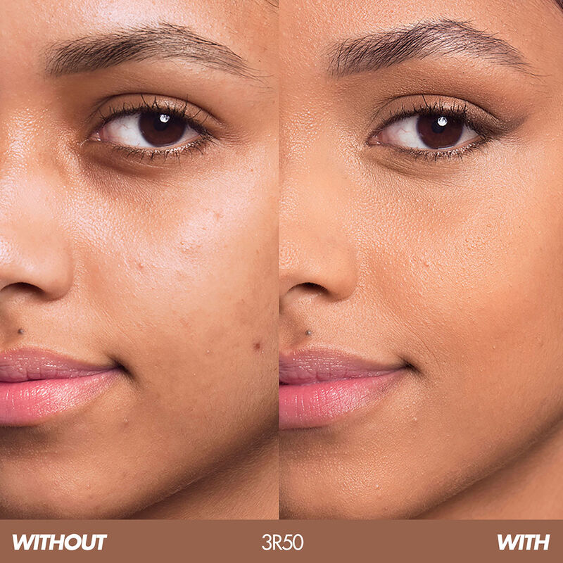 HD SKIN HD SKIN