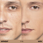 HD SKIN
